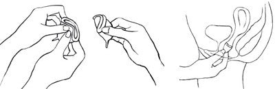 Should My Menstrual Cup Sit Below My Cervix?